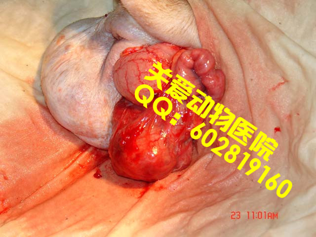 会阴疝3