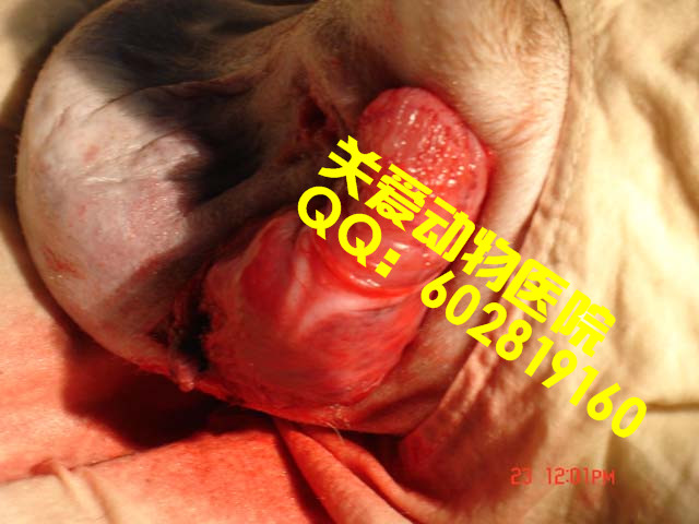 会阴疝4